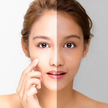 Skin Whitening Treatment | Siddhi Beauty Salon And Makeup Studio | Shop No 01,DK Heights,Near Audumbar Complex,Shree Control Chowk,Narhe,Pune