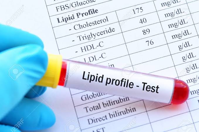 Lipid Profile Test | Shree Pathology Laboratory | Shop No.08, Shiv Shambho Vihar, Ambai Mata Road, Dhayari, Pune. 411041
