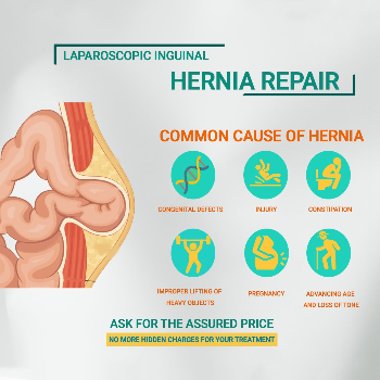 Hernia | Dr Deepak Kumar  General Surgeon ( Advanced Laproscopic & Laser Surgeon) | Haridwar, Uttarakhand 249401, India