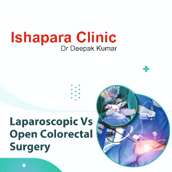 Laparoscopic Surgery (Minimal Access Surgery) Colorectal Surgery | Dr Deepak Kumar  General Surgeon ( Advanced Laproscopic & Laser Surgeon) | Haridwar, Uttarakhand 249401, India