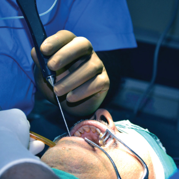 Salivary gland Surgery and omentoplasty | Dr Deepak Kumar  General Surgeon ( Advanced Laproscopic & Laser Surgeon) | Haridwar, Uttarakhand 249401, India