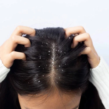 Hair Dandruff Treatment Services in Bhugaon Pune RR UNISEX SALON BHUGAON Shop No 02, Suman Sanskruti Building,Near Maharashtra Gramin Bank,Matalwadi Phata,Bhugaon,Pune