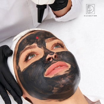 Carbon Peel | Shobhas Marvellous Wellness Center | Shop No 12,Pandhari Complex,Opposite Vegetables Market,Hingane Budrukh,Karve Nagar,Pune