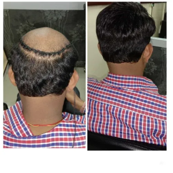 Hair weaving for male | Cdrreams | 565 Shivaji Nagar Near Congress Bhavan And Manapa Bhavan Pune Under Pmc Metro Station Pune 411005