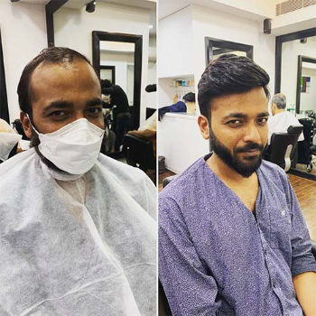 Hair bonding for male and female | Cdrreams | 565 Shivaji Nagar Near Congress Bhavan And Manapa Bhavan Pune Under Pmc Metro Station Pune 411005