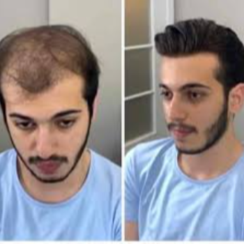 Male hair extensions | Cdrreams | 565 Shivaji Nagar Near Congress Bhavan And Manapa Bhavan Pune Under Pmc Metro Station Pune 411005