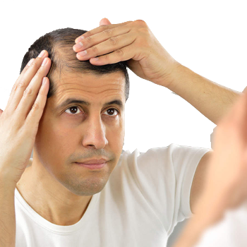 Hereditary baldness solutions with hair system. | Cdrreams | 565 Shivaji Nagar Near Congress Bhavan And Manapa Bhavan Pune Under Pmc Metro Station Pune 411005