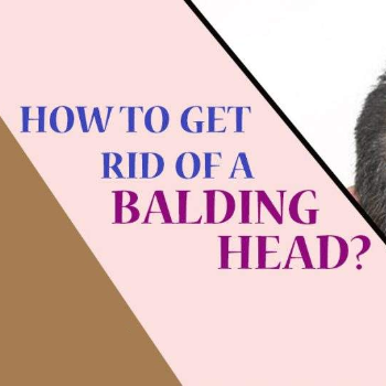 GET RID OF HAIR BALDNESS IN JUST | Cdrreams | 565 Shivaji Nagar Near Congress Bhavan And Manapa Bhavan Pune Under Pmc Metro Station Pune 411005