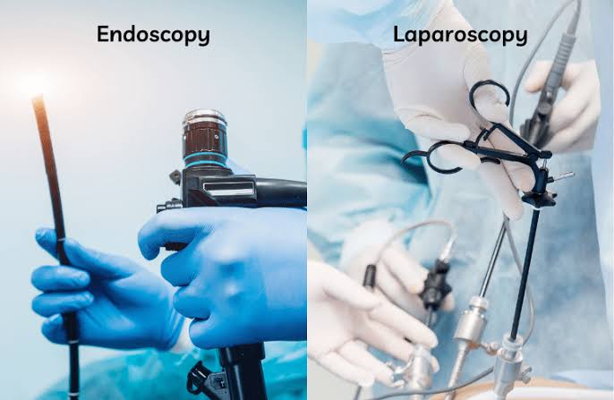 Laparoscopy &amp; Endoscopy | Saidatta Multi Speciality Hospital Marunji,Pune Contact - 8983839963 | Opposite IIMS College, Near Kolte Patil Gate, Marunji Dattawadi, Pune 411057