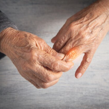 Rheumatoid Arthritis | Best Homeopathy Clinic In Thane, Mumbai | 8th Lane, Anand Nagar Rd, Kopri,Thane, Mumbai, Maharashtra 400603, India