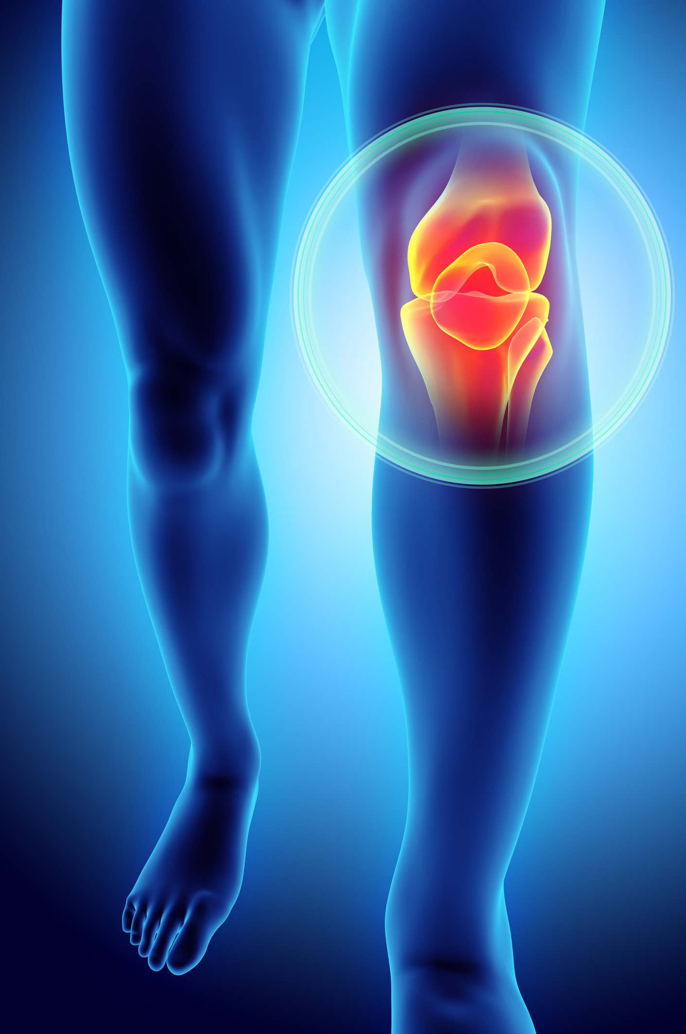 Knee Pain Specialist | Dr.Uttam Sidhaye | 1195/8 Ghole Road, Sanjeevan Surgery, Near Bafna Motors, Shivajinagar, Pune- 411005,Maharashtra, India