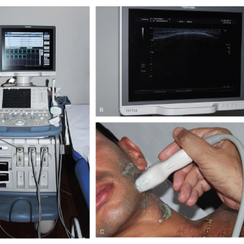 Ultrasonic Scaling | Perfect Dental Clinic Warje | 1st-Swamikrupa Appt.Opp.Tapodham Bus Stop,Warje Malwadi Road,Warje Pune 411058                                                2nd - Shop No 06, Raj Complex Near Chinmay Hospital,Uttam Nagar,NDA Road,Pune 411023