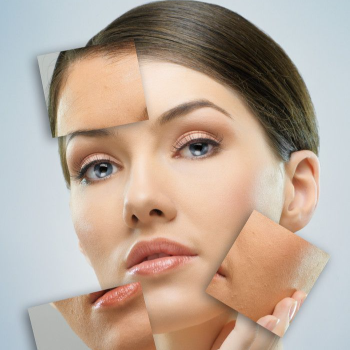 Skin Whitening Treatment | TEJ SKIN & COSMETIC CLINIC | Shop No 3, Arihant Apartment, Sinhgad Institute Road, Near Bank Of  Maharashtra , Ambegaon Budruk, Pune,         Maharashtra 411046,          India