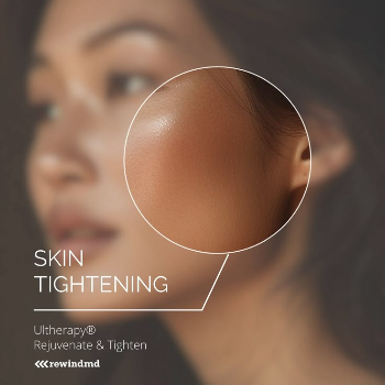 Antiaging Treatment for face lift | TEJ SKIN & COSMETIC CLINIC | Shop No 3, Arihant Apartment, Sinhgad Institute Road, Near Bank Of  Maharashtra , Ambegaon Budruk, Pune,         Maharashtra 411046,          India