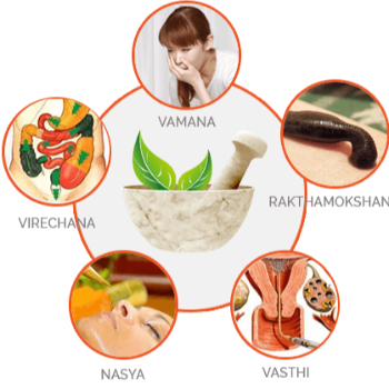 Panchakarma | SHIVANJALI ACCUPUNTURE & NATUROPATHY CLINIC | 106, Dhayari Phata Over Bridge, Wadgaon Budruk, Narhe, Pune, Maharashtra 411041, India