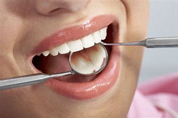 Dental Surgery | Speciality Clinic (Aarogya Clinic) | Daulatpur Road, Pandeypur, Varanasi, Near Kamla Nagar Gate (Opp.-PNB ATM)