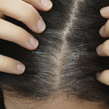 White Hair Treatment | Sai Kesh Hair Oil | Jyotibanagar, Talwade