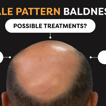 Baldness Treatment | Sai Kesh Hair Oil | Jyotibanagar, Talwade