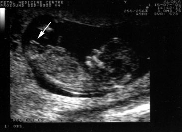 Female Ultrasound | Women's Health Care Clinic And Sonography Centre | Shop No FB-2 1st Floor STC Palm Square Golf Link Colony,Near Dominos, Lalghati Bhopal