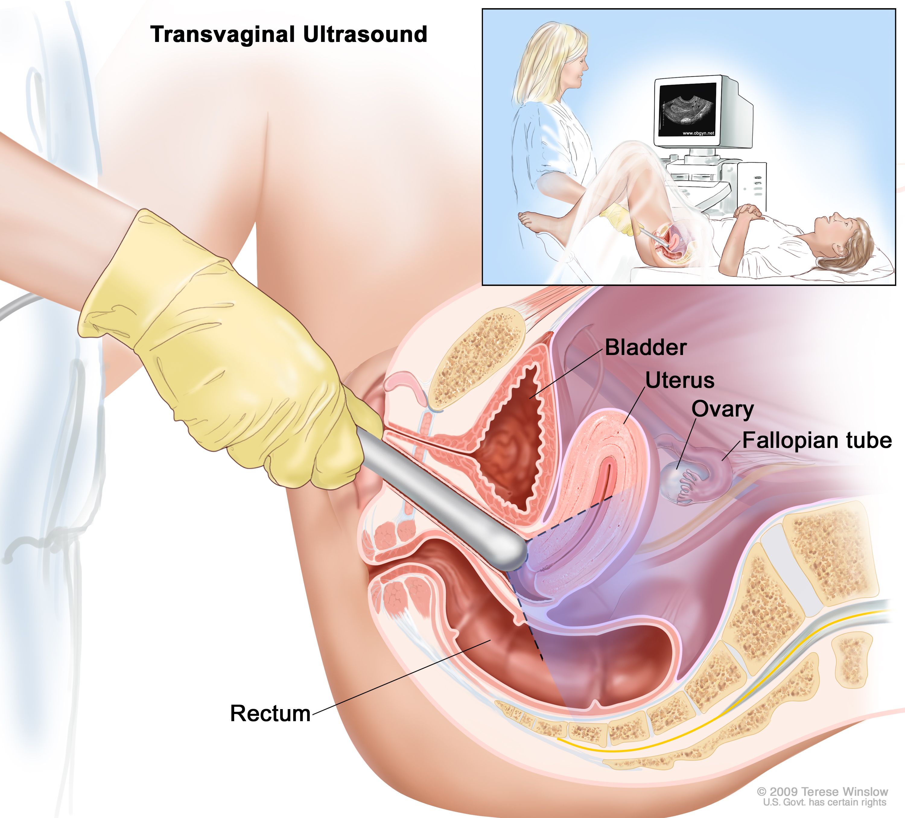 Transvaginal Ultrasonography | Navodaya Sonography Centre | Navodaya Sonography Center 54 Motiya Talab Road
Infront Of Subham Hospital Opposite To Bhopal Care Hospital Bhopal