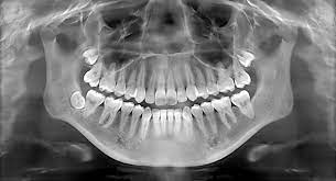 Dental X-ray My Family Dentist Dental Implant Center (MFD-HARIDWAR) Haridwar, Uttarakhand 249403, India