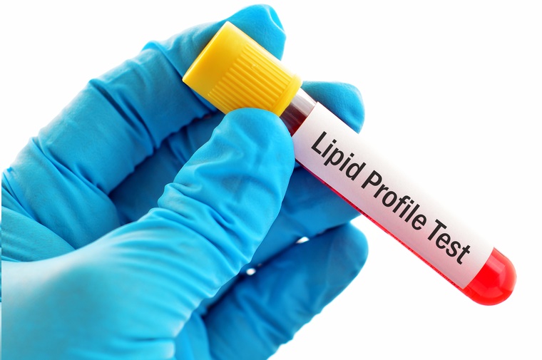 Lipid Profile Test | Prachi Diagnostic Centre | 10,Shree Audumber Heights Dattawadi, MIDC Rd, Near Shabari Hotel, East, Badlapur, Maharashtra 421503, India