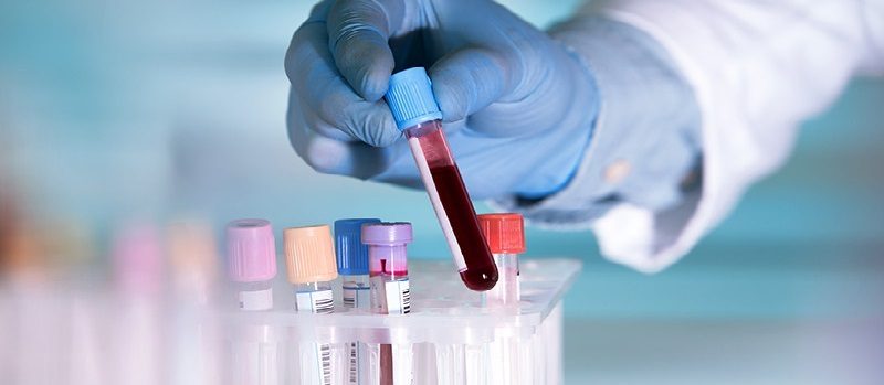 Calcium Test: | Prachi Diagnostic Centre | 10,Shree Audumber Heights Dattawadi, MIDC Rd, Near Shabari Hotel, East, Badlapur, Maharashtra 421503, India