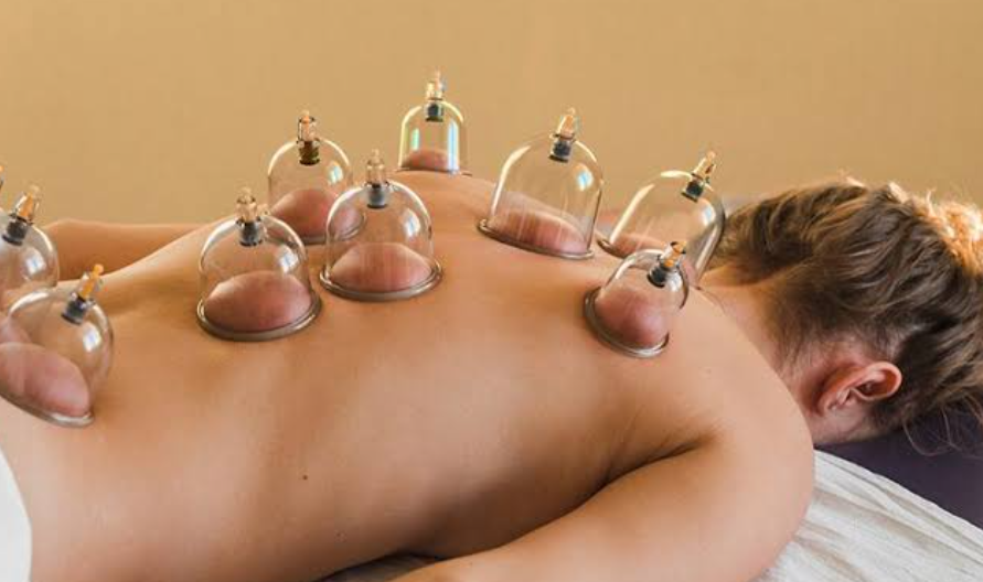 Cupping Therapy | Vatsalya Clinic | Narhe