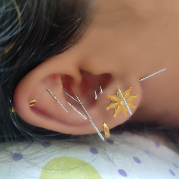 Acupuncture Center in Tagore Nagar raipur | Nature Acu Health Care Centre | C/137, Tagore Nagar, Raipur, Tikrapara, Chhattisgarh 492001, India