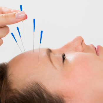 Migraine Treatment | Nature Acu Health Care Centre | C/137, Tagore Nagar, Raipur, Tikrapara, Chhattisgarh 492001, India