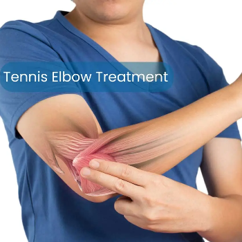 Tennis Elbow Treatment | Nature Acu Health Care Centre | C/137, Tagore Nagar, Raipur, Tikrapara, Chhattisgarh 492001, India