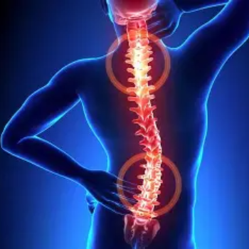 Cervical Spondylitis | Nature Acu Health Care Centre | C/137, Tagore Nagar, Raipur, Tikrapara, Chhattisgarh 492001, India