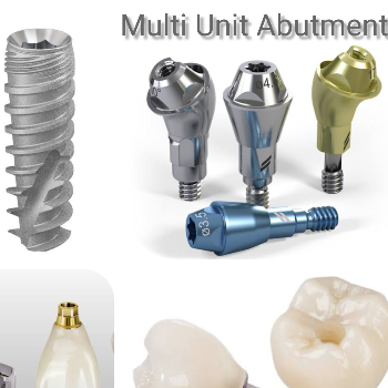 Dental Implant | Dr Care Dental Hospital | Dental Clinic | Dentist | H.NO-8-7-91/17/1, SREE HOMES, Nagarjuna Sagar Rd, Padmavathi Nagar, Hasthinapuram South, Hastinapuram,