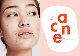 Skin diseases | Navjeevan Multi-Speciality Clinic | Shop No.3, Ambai, Amba Mata Mandir Rd, Dhiree Village, Dhayari, Pune, Khadewadi, Maharashtra 411041, India