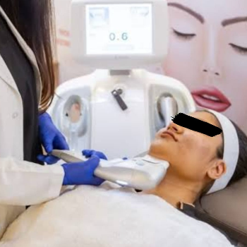 LASER HAIR REDUCTION 4000 onwards | Shree Sai Clinic | Shop No. 15, Shrirang, ZEAL COLLEGE OF ENGINEERING AND RESEARCH, Chowk, Dhayari Narhe Rd, Narhe, Pune, Maharashtra 411041, India