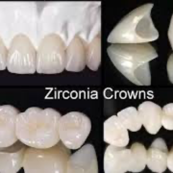 Zirconium Crown In Hasthinapuram | Dr Care Dental Hospital | Dental Clinic | Dentist | H.NO-8-7-91/17/1, SREE HOMES, Nagarjuna Sagar Rd, Padmavathi Nagar, Hasthinapuram South, Hastinapuram,