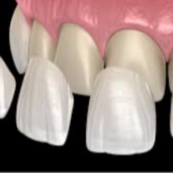 Smile Designing In Hasthinapuram | Dr Care Dental Hospital | Dental Clinic | Dentist | H.NO-8-7-91/17/1, SREE HOMES, Nagarjuna Sagar Rd, Padmavathi Nagar, Hasthinapuram South, Hastinapuram,