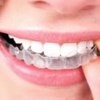 Invisible Braces At Vanasthalipuram, Hyderabad | Dr Care Dental Hospital | Dental Clinic | Dentist | H.NO-8-7-91/17/1, SREE HOMES, Nagarjuna Sagar Rd, Padmavathi Nagar, Hasthinapuram South, Hastinapuram,