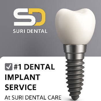 ⭐ 2. Specialised Dental Implants & Full Mouth Implants  