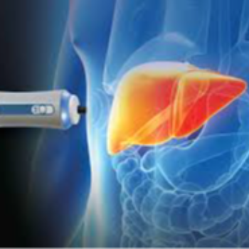 FIBROSCAN | Prime Hospital | 347/7,  Opposite Gangapuri Road, Sanoli Road, Panipat, Haryana, 132103