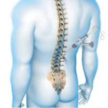 Spine Surgery | Prime Hospital | 347/7,  Opposite Gangapuri Road, Sanoli Road, Panipat, Haryana, 132103