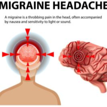 Migraine Dr Amit Kumar Gupta, Homeopathic Doctor Ghaziabad, Uttar Pradesh 201010, India