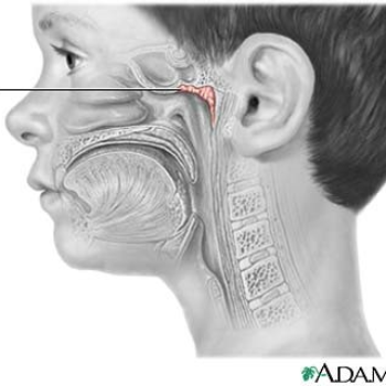 Adenoid Dr Amit Kumar Gupta, Homeopathic Doctor Ghaziabad, Uttar Pradesh 201010, India