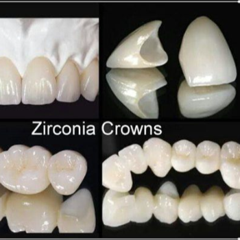 Dr Care Dental Hospital For Zirconium Crown In Hyderabad Telangana India | Dr Care Dental Hospital | Dental Clinic | Dentist | 17/1, SREE HOMES, H.NO-8-7-91, Nagarjuna Sagar Rd, Near Me, Padmavathi Nagar, Hasthinapuram South, Hastinapuram, Hyderabad, Telangana 500070