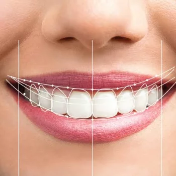 Smile Designing in Jaipur - Smile Carve Dental Clinic at Dental Clinic in C Scheme, Jaipur — Smile Carve, Jaipur
