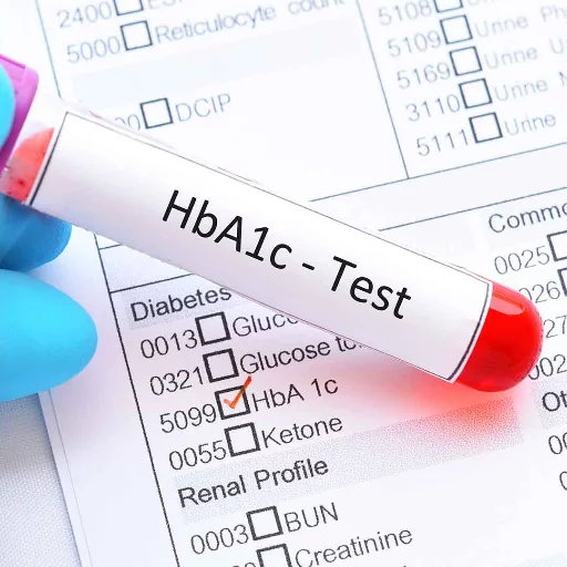 HBA1C BLOOD TEST in KALOL — REHANSHI DIAGNOSTICS