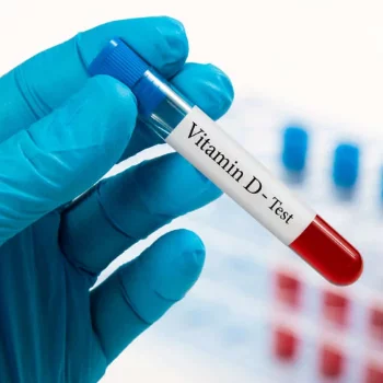 Vitamin D3 Test in KALOL — REHANSHI DIAGNOSTICS