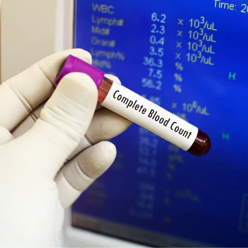 CBC BLOOD TEST in KALOL — REHANSHI DIAGNOSTICS