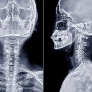 Digital X-ray Services at Shriraj Diagnostic Centre | Shriraj Diagnostic Centre | H-1132, Rajiv Vihar, Scheme No. 114, Near By Atuliya Mediical, Part I, Vijay Nagar, Indore, Madhya Pradesh 452010, भारत