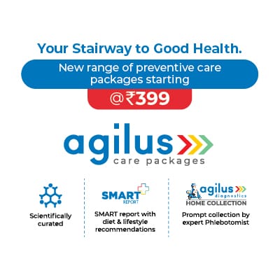 CBC Blood Test | Agilus Diagnostic (SRL Diagnostics) | Gandhi Path West Maa Hinglaj Nagar B Shop No. 1 Vaishali Nagar Jaipur Rajasthan 302021